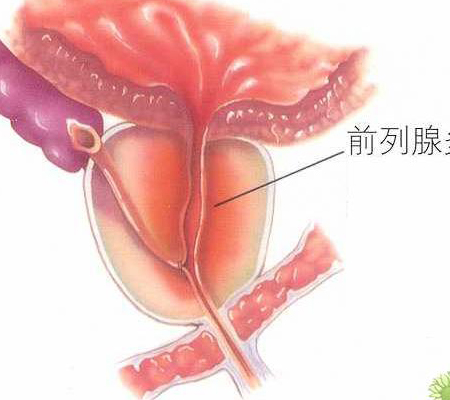 男人该如何知道自己惹上了前列腺炎