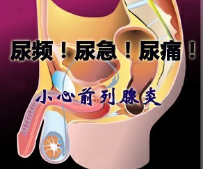 前列腺炎预防需要怎么做