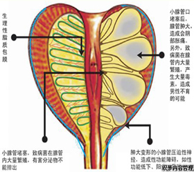 导致前列腺痛的原因有哪些